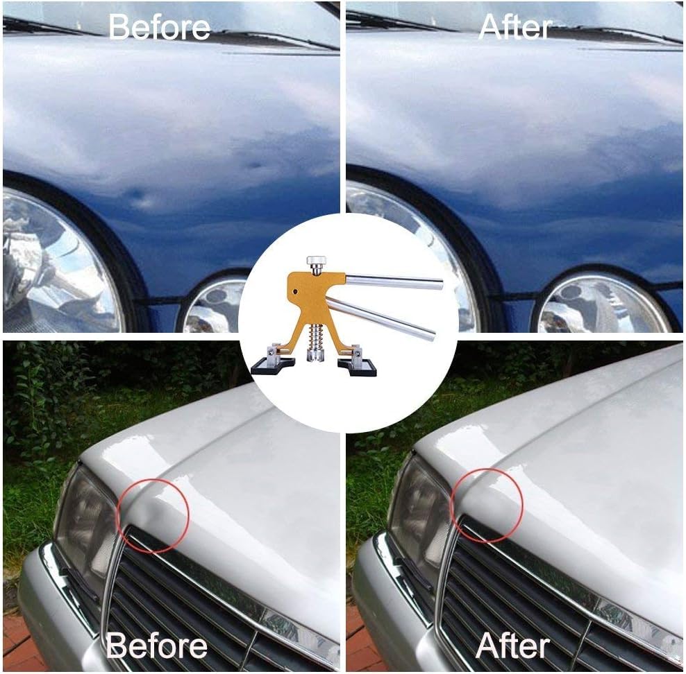 GLISTON adjustable golden dent lifter close-up showing height adjustment and durable metal