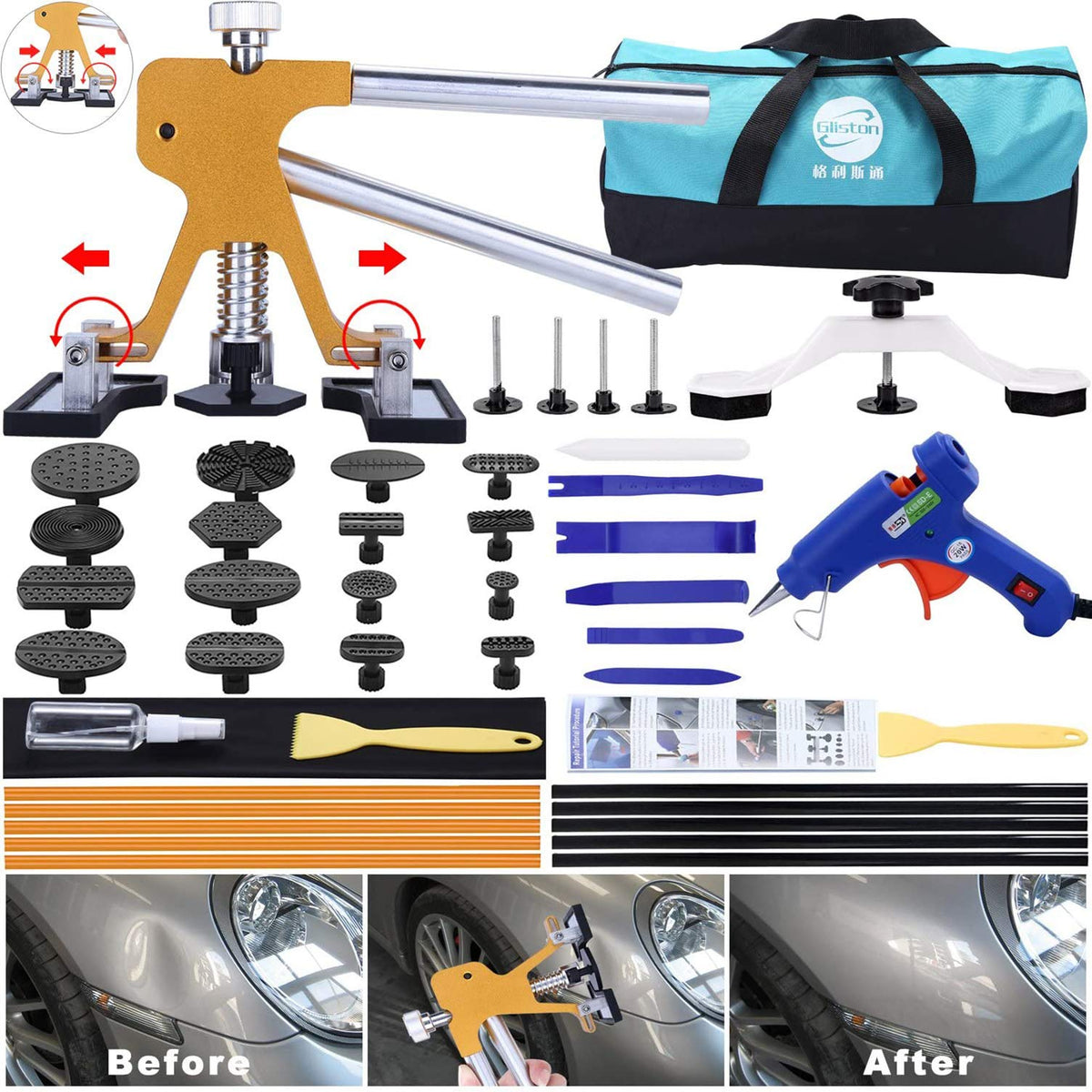 GLISTON front packaging showing full 45pcs kit and accessories for quick identification